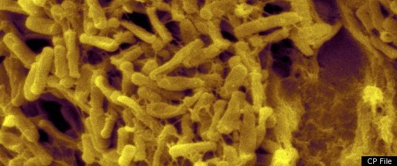 Clostridium difficile, a gram-positive, rod-shaped bacterium, produces toxins that cause inflammation of the intestinal wall (pseudomembranous colitis) along with diarrhea, abdominal pain, and fever. It is resistant to most antibiotics and a common hospital-acquired infection (CP) | CP File 2011.