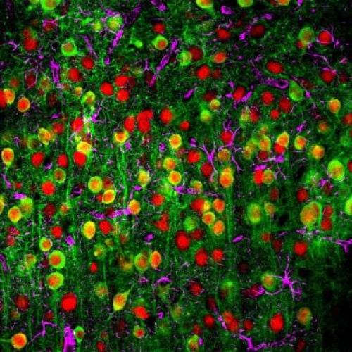 This is a two-photon microscopy image showing a calcium sensor (green), the nuclei of neurons (red) and supporting cells called astrocytes (magenta). Credit: John Issa/Johns Hopkins Medicine.