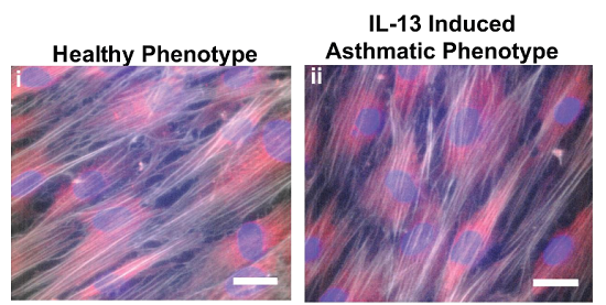 Bronchial smooth muscle phenotype.  Example tissues immunostained for f-actin (white) to detect the actin cytoskeleton, α-smooth muscle actin (red) to identify muscular phenotype, and nuclei (blue). Scale bar is 25 μm.  Parker et al 2014.
