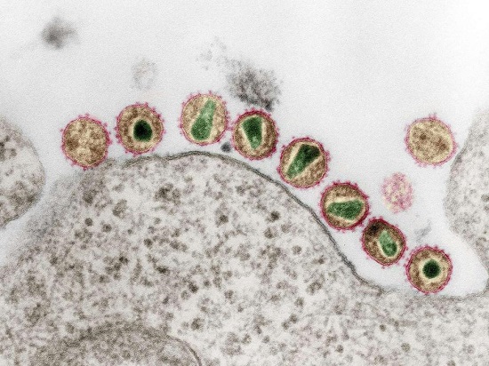 Electron micrograph of HIV-1 (retroviruses).  Credit:  Hans R. Gelderblom.  Coloration: Andrea Schnartendorff / RKI.