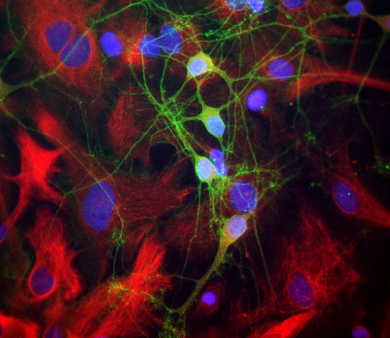 Mixed neuron-glial cultures stained with rabbit antibody to alpha-II spectrin (green) and mouse polyclonal antibody to Nestin (red). The alpha-II spectrin antibody stains numerous axonal and dendritic profiles in these cultures, clearly revealing the submembranous cytoskeleton. Since alpha-II spectrin is specific for neurons in the CNS, the glial cells in this culture are not recognized by this antibody.  ©EnCor Biotechnology Inc. 2014.  