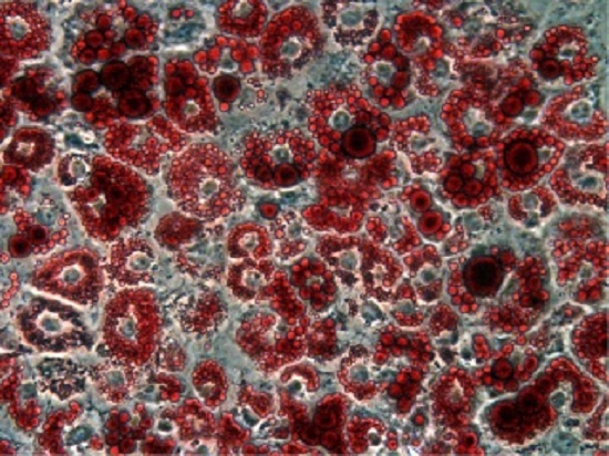 Identification of regulatory genes and pathways in white adipogenic precursors.  White preadipocytes were induced to differentiate in culture to form mature, lipid storing adipocytes. The cells are fixed and lipid droplets are stained red with oil-red-o.  Credit:  University of Pennsylvania 2014.