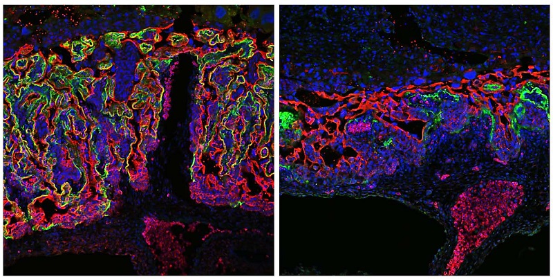 Development of the placenta of a mouse The placental labyrinth forms the interface between the blood circulation of the embryo (bottom) and the mother (top). Two of its cell layers are immunofluorescence-stained in red and green, respectively. In the left image the labyrinth is normally developed. In the right image the labyrinth is compact and its branching is impaired, because the gene regulator Grhl2 was inactivated.  (Photo: Katharina Walentin/Copyright: MDC) 