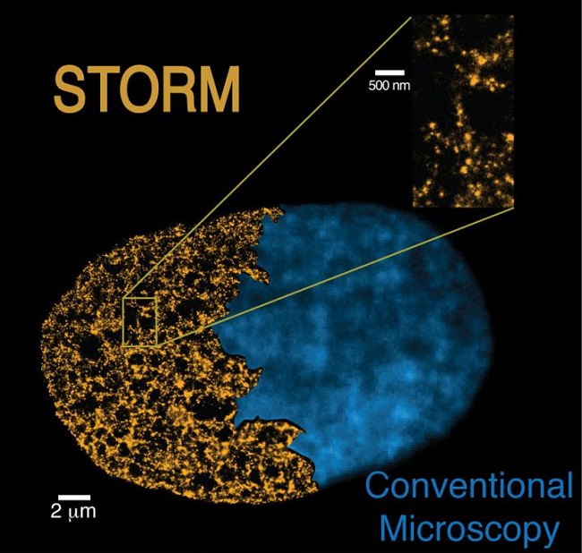This is a comparison between an image of the nucleus of a cell obtained with the STORM technique (left yellow image) and one obtained with conventional microscopes (right blue image). The STORM technique shows its power to resolve the genome structure at the nano-scale.  Credit:  CRG/ICFO. 