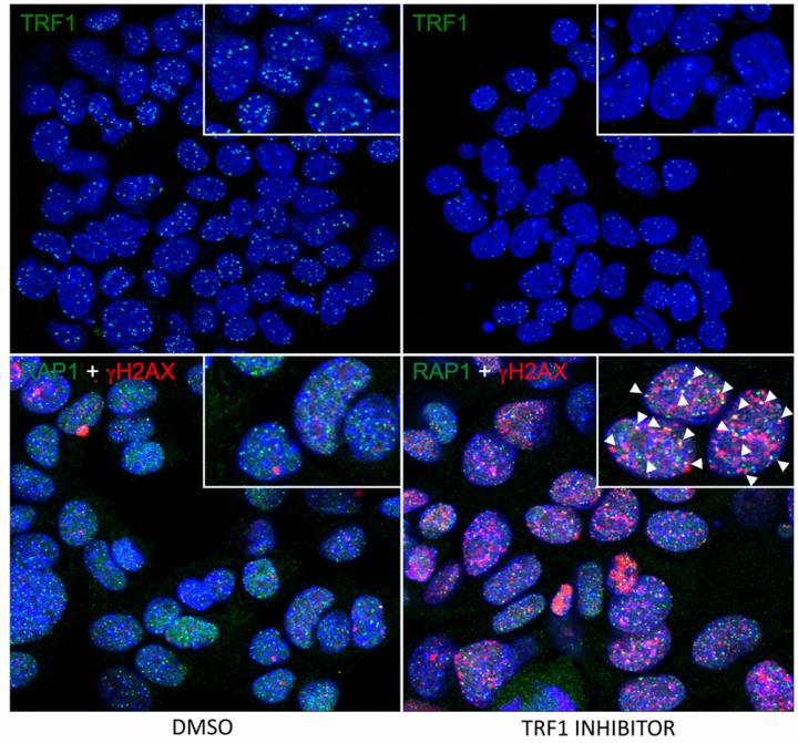 Lung cancer cells treated with the CNIO TRF1 inhibitor ETP-47037 (right) show less TRF1 bound to the telomeres (green, top), more telomeric DNA damage (pink, bottom), and therefore, an acute telomere uncapping, than non-treated cancer cells (left).  Credit:  CNIO. 