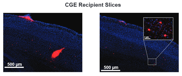 Laminar distribution of inhibitory neurons from CGE and MGE transplantations.  Example sections from a CGE recipient cells 42 days after transplantation (DAT) into adult visual cortex that express the GABAergic neuron marker VGAT (red).  Many transplanted inhibitory cells are found close to the injection site (left). Some transplanted CGE cells migrate into the adult cortical tissue (right).  Inhibitory Neuron Transplantation into Adult Visual Cortex Creates a New Critical Period that Rescues Impaired Vision.  Gandhi et al 2015.
