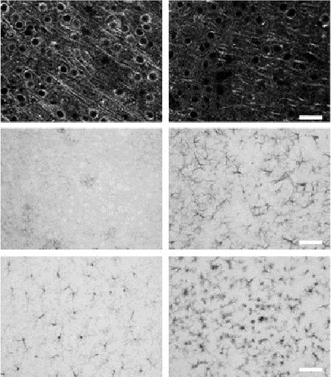 Neurodegeneration and gliosis induced by kainic acid (KA). Mice were injected with 20 mg/kg KA or vehicle (VEH), and euthanized 2 or 7 days later.  Histological quantitation of neurodegeneration was performed on fluorescently labeled microtubule-associated protein 2 (MAP2; neuron dendrites and cell bodies) sections. Quantitation of gliosis was performed on immunoperoxidase glial fibrillary acid protein (GFAP; reactive astrocytes) and ionizing calcium-binding adaptor molecule 1. Qualitative images show examples of MAP2, GFAP, and IBA1 immunostains on VEH- or KA-treated mice. Results obtained for the synaptic markers synaptophysin were similar to those of MAP2. The extent of neurodegeneration and gliosis was similar at 2 and 7 days, probably a reflection of the high sensitivity of the FVB/N mouse strain to excitotoxicity.  The Mouse Brain Metabolome.  Buttini et al 2015.