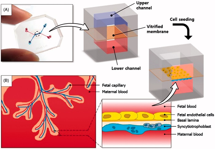 A placenta-on-a-chip microdevice: (A) The microengineered device is composed of the upper (blue) and lower (red) PDMS chambers separated by a vitrified collagen membrane. (B) Endothelial cells and trophoblasts are co-cultured in close apposition on the opposite sides of the intervening membrane to form a microengineered placental barrier in the placenta-on-a-chip device.  Placenta-on-a-chip: a novel platform to study the biology of the human placenta.  Huh et al 2015. 