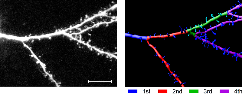 Dendritic development in animals transiently expressing DISC1cc.  Example of L2/3 cell dendrites showing spines and dendritic order. Scale bar=10 microns. Growth  in  dendrites  charted  as  an  increase  in  internodal  distances.  The  change  in  median  internodal  distance  is  given  as  percentage  of  the  internodal distance at the start of the period.  Adult cortical plasticity depends on an early postnatal critical period.   Hardingham et al 2015.
