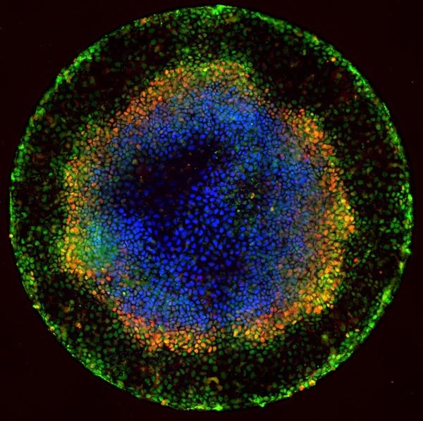 As seen under a microscope, human embryonic cells (colored dots) confined to areas of precisely controlled size and shape start to specialize and form distinct layers similar to those seen in early development. Credit: Aryeh Warmflash, Rockefeller University.