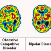 Medicalising, differentiating between major depressive and bipolar disorder.
