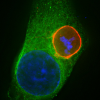 Previously unknown interaction between malaria parasites and liver cells identified.