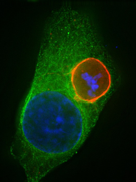 Liver stage with Actin is shown. Credit: Center for Infectious Disease Research.