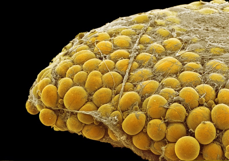 Fat tissue. Coloured scanning electron micrograph (SEM) of a sample of fat tissue, showing fat cells (adipocytes, orange) surrounded by fine strands of supportive connective tissue. Adipocytes are among the largest cells in the human body, each cell being 100 to 120 microns in diameter. Almost the entire volume of each fat cell consists of a single lipid (fat or oil) droplet. Adipose tissue forms an insulating layer under the skin, storing energy in the form of fat, which is obtained from food.  Credit: STEVE GSCHMEISSNER/SCIENCE PHOTO LIBRARY.