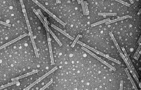 Negatively-stained TEM image of amyloid-like fibrils.