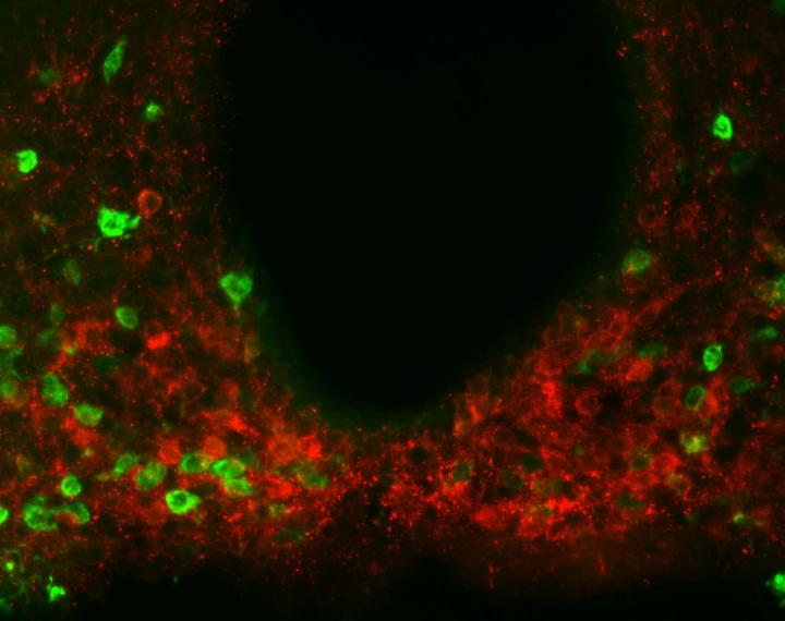 Scientists found evidence of the metabolism-regulating protein amylin, shown in red, present in multiple regions throughout a brain area called the hypothalamus. Experiments suggest amylin produced by hypothalamic neurons helps reduce food consumption together with leptin. Credit: Laboratory of Molecular Genetics at The Rockefeller University/Cell Metabolism. 