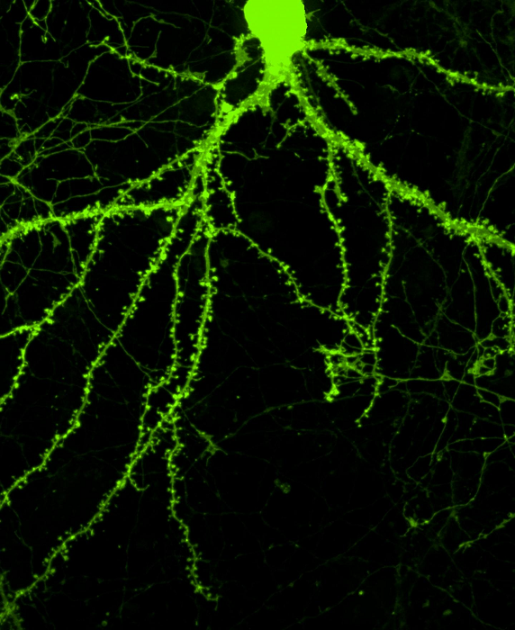 Tiny thornlike structures along the branches of this neuron are dendritic spines, which form the receiving end of synapses. Treatment with a novel compound induced the cell to sprout 20 to 25 percent more spines than a normal, untreated neuron.  Credit: Jessica Cifelli.