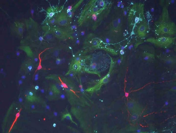 When stem cells from the old brain are cultured with signals of a young choroid plexus they can divide and form new neurons (red).  Credit: Biozentrum, University of Basel. 