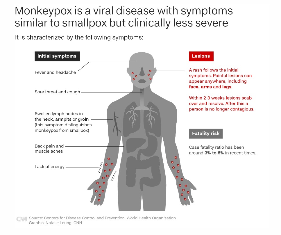 artwork healthinnovations monkeypox who cnn